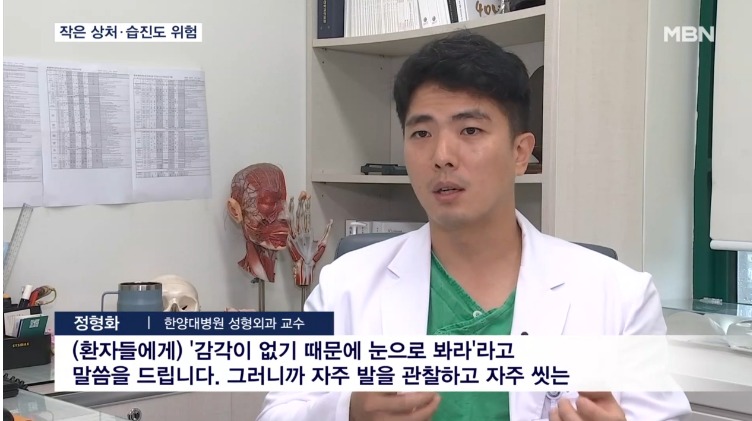덥고 습한 날씨엔 당뇨 환자 '당뇨발' 주의…샌들·슬리퍼 피해야